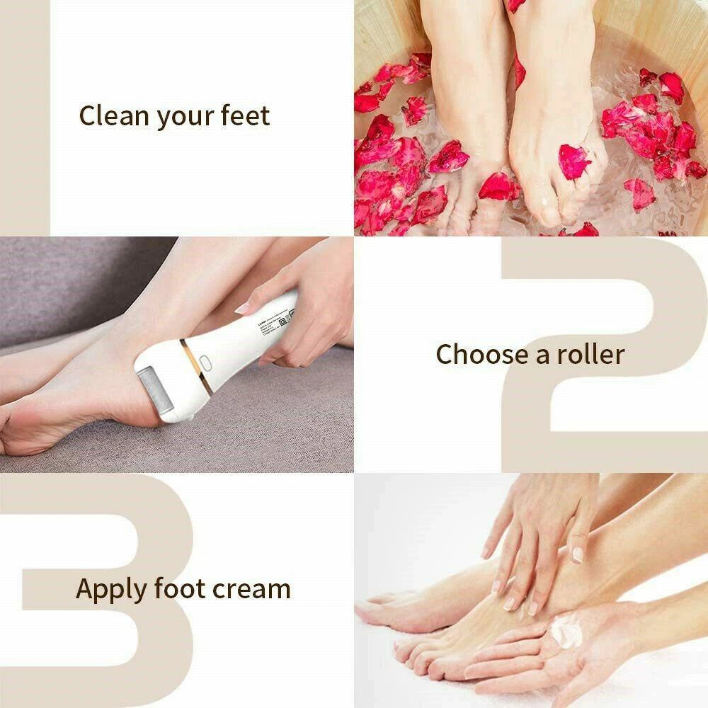 Portable Electric Foot Callus Remover image 2