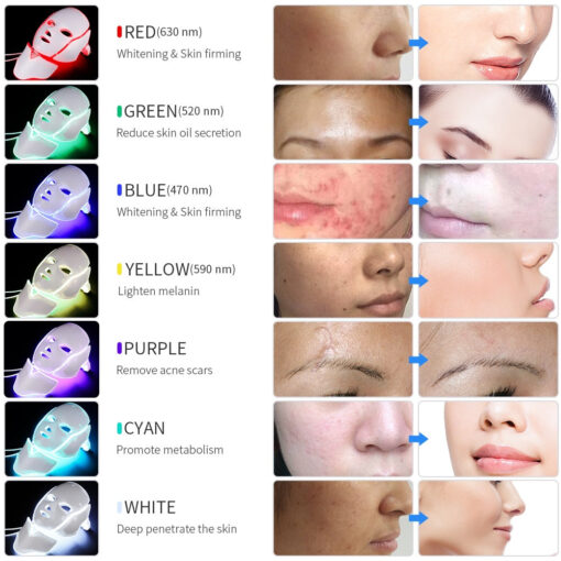 LED Light Therapy Acne Face Mask - Image 5