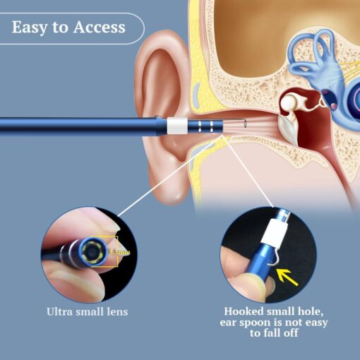 Premium Digital Phone Otoscope Camera 3 in 1 - Image 4