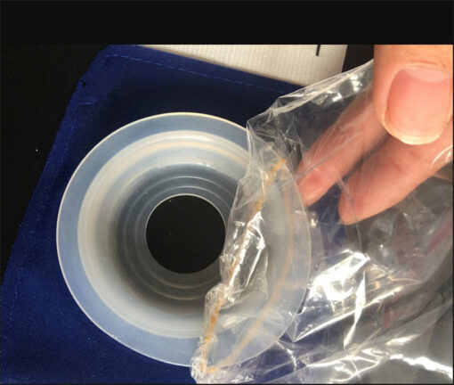 Ostomy Bag Belt For Ileostomy/Colonoscopy/Urostomy - Image 4