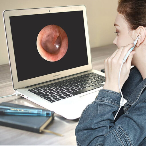 Premium Digital Phone Otoscope Camera 3 in 1 - Image 8