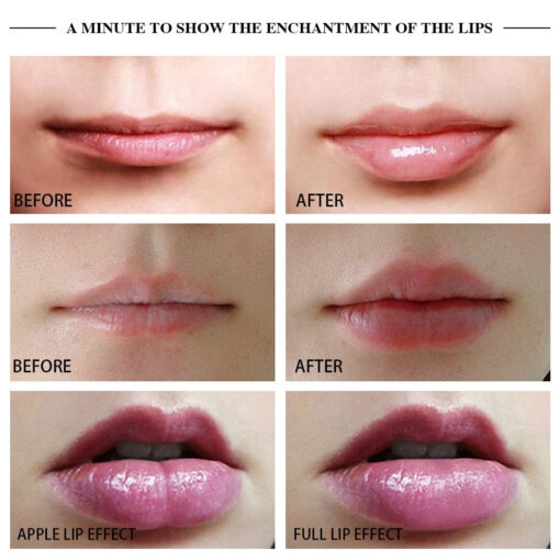 Premium Lip Plumper Handheld Device - Image 5